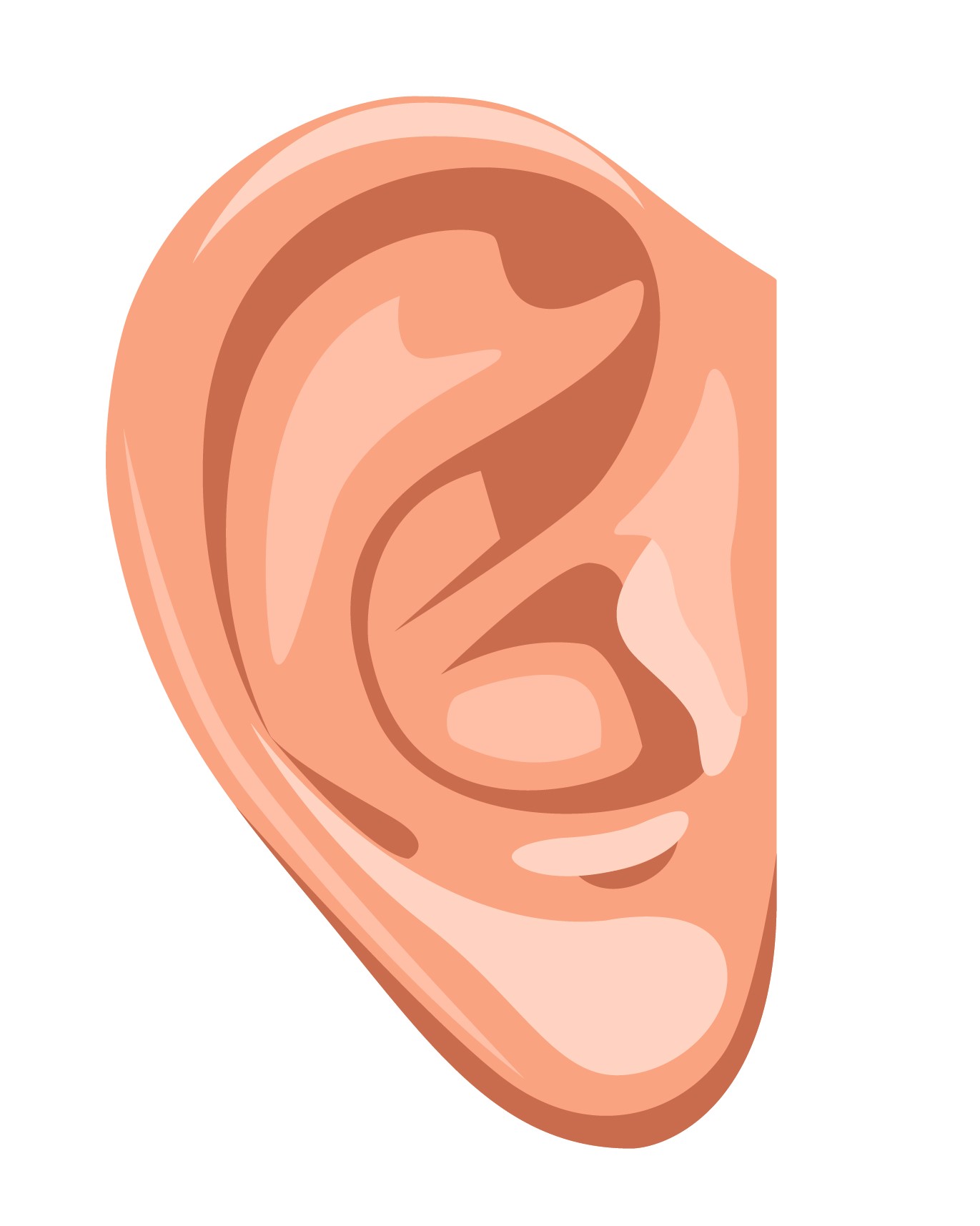 Utstående ører - Aurikkelplastikk - Øreplastikk